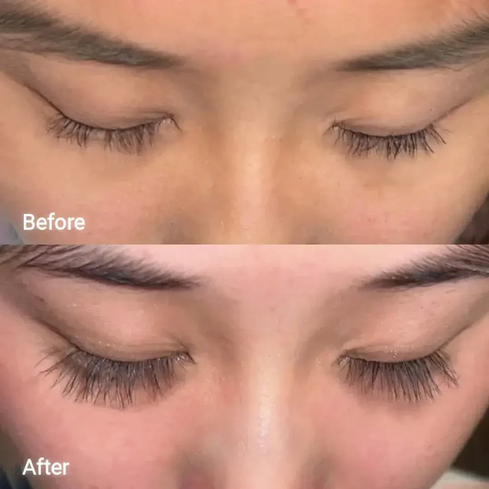 Archella™ Eyelash Growth Serum